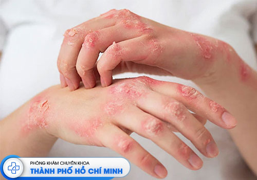 6-bac-si-chua-viem-da-co-dia-gioi-tphcm