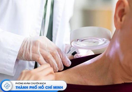 6-bac-si-chua-viem-da-co-dia-gioi-tphcm