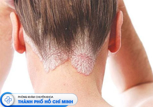 8-phong-kham-da-lieu-ngoai-gio-uy-tin-tai-tphcm