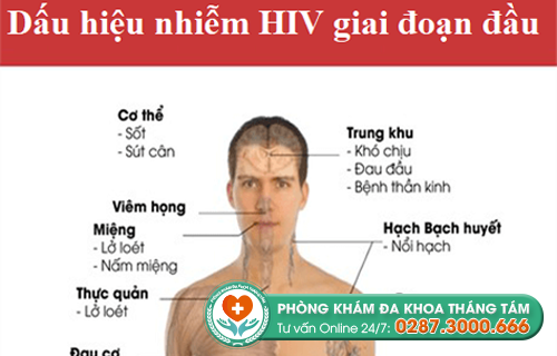 Dấu hiệu nhiễm HIV giai đoạn đầu