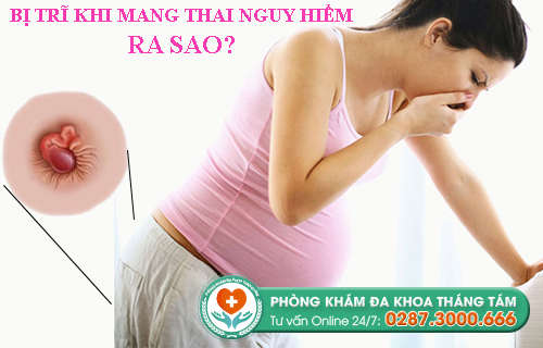 Hình ảnh bị trĩ khi mang thai