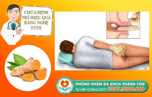 Chữa trĩ bằng nghệ tươi