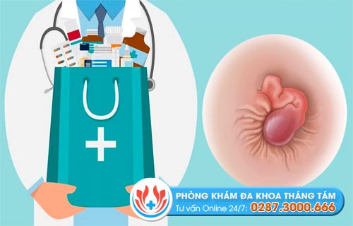 Những phương pháp điều trị bệnh trĩ