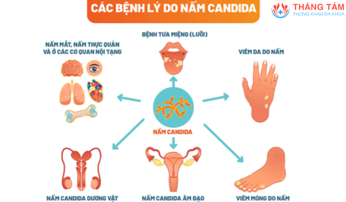 Nấm candida