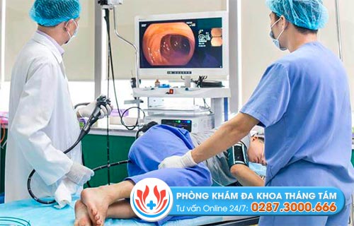 Các loại nội soi hậu môn trực tràng