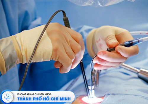 cat-tri-o-dau-uy-tin-tai-tphcm