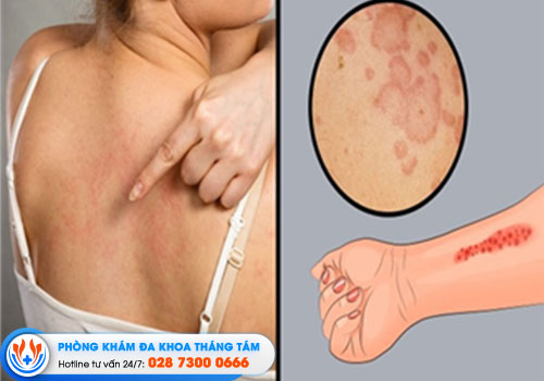 diem-danh-nhung-phong-kham-da-lieu-huyen-hoc-mon-co-chat-luong-tot-hien-nay