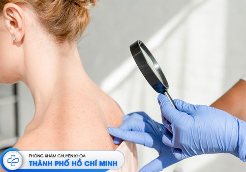 top-10-phong-kham-da-lieu-uy-tin-tai-tphcm