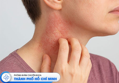 top-10-phong-kham-da-lieu-uy-tin-tai-tphcm