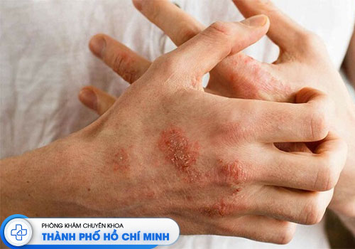 top-6-bac-si-da-lieu-gioi-o-tphcm